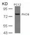 Protein Kinase C Theta antibody, AP02782PU-N, Origene, Western Blot image 
