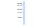 Phosphatidylinositol Transfer Protein Beta antibody, NBP1-55310, Novus Biologicals, Western Blot image 