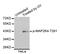 Mitogen-Activated Protein Kinase Kinase 4 antibody, STJ22242, St John