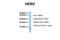 Endogenous Retrovirus Group FRD Member 1, Envelope antibody, NBP1-79613, Novus Biologicals, Western Blot image 