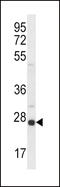 Sigma Non-Opioid Intracellular Receptor 1 antibody, 61-478, ProSci, Western Blot image 