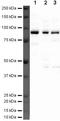 Cartilage Oligomeric Matrix Protein antibody, PA5-19850, Invitrogen Antibodies, Western Blot image 