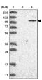 Poly(ADP-Ribose) Polymerase Family Member 10 antibody, PA5-55772, Invitrogen Antibodies, Western Blot image 