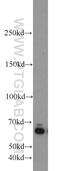 Zinc Finger CCCH-Type And G-Patch Domain Containing antibody, 23203-1-AP, Proteintech Group, Western Blot image 