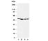 Mitogen-Activated Protein Kinase Kinase 1 antibody, R30445, NSJ Bioreagents, Western Blot image 