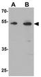 Transmembrane Protein 135 antibody, GTX31532, GeneTex, Western Blot image 