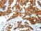 ABI Family Member 3 Binding Protein antibody, LS-C402592, Lifespan Biosciences, Immunohistochemistry paraffin image 