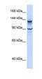 PiggyBac Transposable Element Derived 1 antibody, orb329860, Biorbyt, Western Blot image 