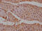 Protein Tyrosine Phosphatase Non-Receptor Type 11 antibody, CSB-RA289762A0HU, Cusabio, Immunohistochemistry paraffin image 