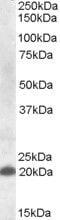 C-Type Lectin Domain Family 4 Member C antibody, PA5-19123, Invitrogen Antibodies, Western Blot image 