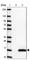 Leucine Rich Melanocyte Differentiation Associated antibody, HPA047446, Atlas Antibodies, Western Blot image 