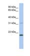 C-Type Lectin Like 1 antibody, orb325837, Biorbyt, Western Blot image 