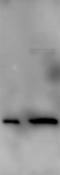 Synuclein Alpha antibody, LS-C204586, Lifespan Biosciences, Western Blot image 