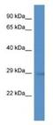 Gem Nuclear Organelle Associated Protein 2 antibody, NBP1-80445, Novus Biologicals, Western Blot image 