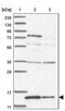 Retinol Binding Protein 7 antibody, PA5-57043, Invitrogen Antibodies, Western Blot image 