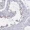 Lysine Demethylase 4D antibody, NBP2-47413, Novus Biologicals, Immunohistochemistry paraffin image 