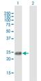 Apolipoprotein B MRNA Editing Enzyme Catalytic Subunit 3B antibody, H00009582-B01P, Novus Biologicals, Western Blot image 