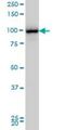 TBC1 Domain Containing Kinase antibody, H00093627-M01, Novus Biologicals, Western Blot image 