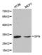 Stratifin antibody, LS-C192516, Lifespan Biosciences, Western Blot image 
