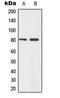 Tumor Protein P73 antibody, LS-C352961, Lifespan Biosciences, Western Blot image 