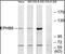 EPH Receptor B6 antibody, orb96029, Biorbyt, Western Blot image 