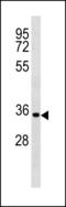 Cyclin D2 antibody, LS-C203892, Lifespan Biosciences, Western Blot image 