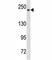 Notch Receptor 3 antibody, F53650-0.1ML, NSJ Bioreagents, Western Blot image 