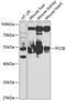 Propionyl-CoA Carboxylase Subunit Beta antibody, GTX33390, GeneTex, Western Blot image 