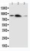 Amyloid Beta Precursor Like Protein 2 antibody, PA1654-1, Boster Biological Technology, Western Blot image 