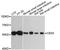 Carboxylesterase 3 antibody, A4558, ABclonal Technology, Western Blot image 