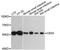 Fatty acid ethyl ester synthase antibody, A4558, ABclonal Technology, Western Blot image 