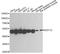 Elongation factor 1-gamma antibody, A2721, ABclonal Technology, Western Blot image 