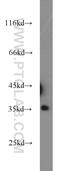 Protein Phosphatase 4 Catalytic Subunit antibody, 10262-1-AP, Proteintech Group, Western Blot image 