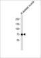 Gamma-Aminobutyric Acid Type A Receptor Theta Subunit antibody, M11195, Boster Biological Technology, Western Blot image 