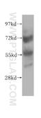 Zinc Finger Protein 266 antibody, 11374-1-AP, Proteintech Group, Western Blot image 