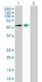 Adenosine Deaminase Domain Containing 1 antibody, H00132612-B01P, Novus Biologicals, Western Blot image 