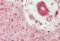 Herpes Simplex Virus tag antibody, orb248961, Biorbyt, Immunohistochemistry paraffin image 