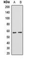 Fibrinogen Beta Chain antibody, LS-C668500, Lifespan Biosciences, Western Blot image 