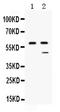 Carboxypeptidase B2 antibody, PB9997, Boster Biological Technology, Western Blot image 