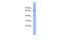 Acyl-CoA Binding Domain Containing 3 antibody, GTX44881, GeneTex, Western Blot image 