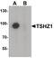 Teashirt Zinc Finger Homeobox 1 antibody, PA5-34342, Invitrogen Antibodies, Western Blot image 