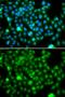 N-6 Adenine-Specific DNA Methyltransferase 1 antibody, GTX32649, GeneTex, Immunocytochemistry image 