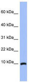 Acyl-CoA Binding Domain Containing 7 antibody, TA335983, Origene, Western Blot image 