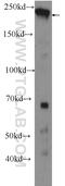 Claspin antibody, 23206-1-AP, Proteintech Group, Western Blot image 