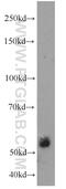 Extracellular Matrix Protein 1 antibody, 11521-1-AP, Proteintech Group, Western Blot image 