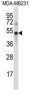 Ubiquitin Specific Peptidase 46 antibody, abx027846, Abbexa, Western Blot image 