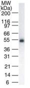 LCK Proto-Oncogene, Src Family Tyrosine Kinase antibody, GTX13699, GeneTex, Western Blot image 