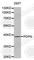 Podoplanin antibody, A0956, ABclonal Technology, Western Blot image 