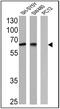 Nerve Growth Factor Receptor antibody, MA5-13314, Invitrogen Antibodies, Western Blot image 