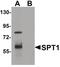 SPTLC1 antibody, PA5-21141, Invitrogen Antibodies, Western Blot image 